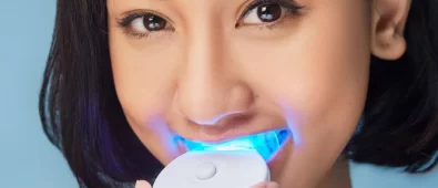 The Benefits of Over-the-Counter Teeth Whitening