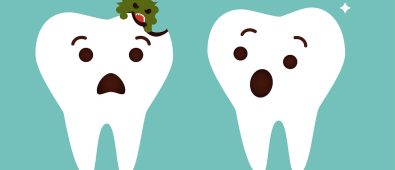 What Causes Tooth Decay and How to Prevent it