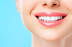Top 5 Facts About Teeth Whitening