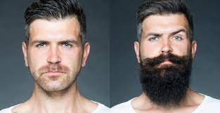 Minoxidil for beard and mustache how to start the treatment