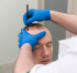 The Real Hair Transplant Cost in London: What Patients Should Expect